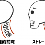 生理的前弯とストレートネック